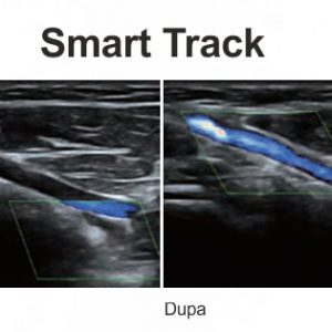 Doppler Color Mindray DC 70 X-Insight – Ecograf performant